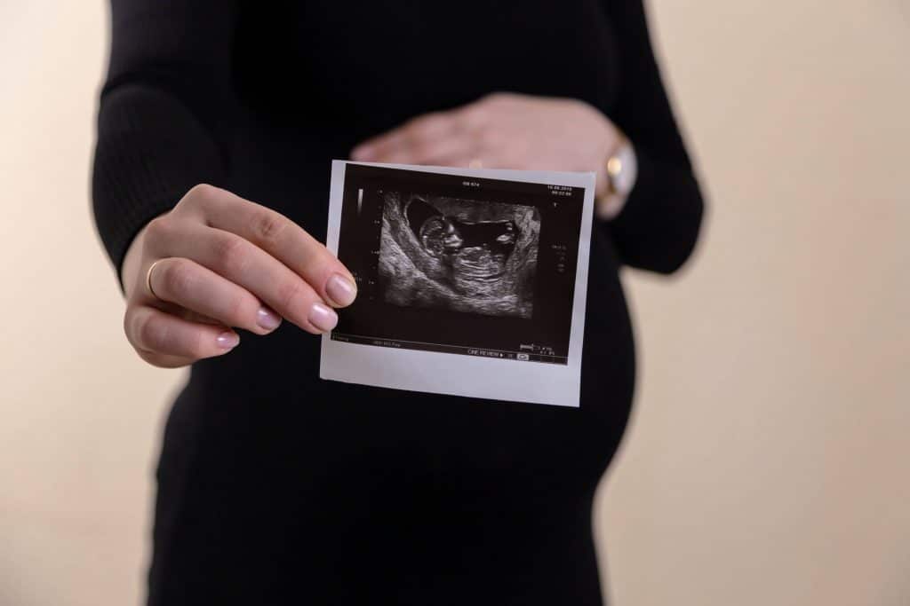 Le cycle de la vie commence : future maman tenant l’échographie de son bébé
